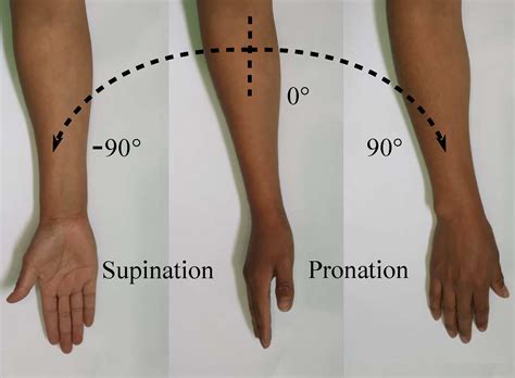 pronation gefährlich.